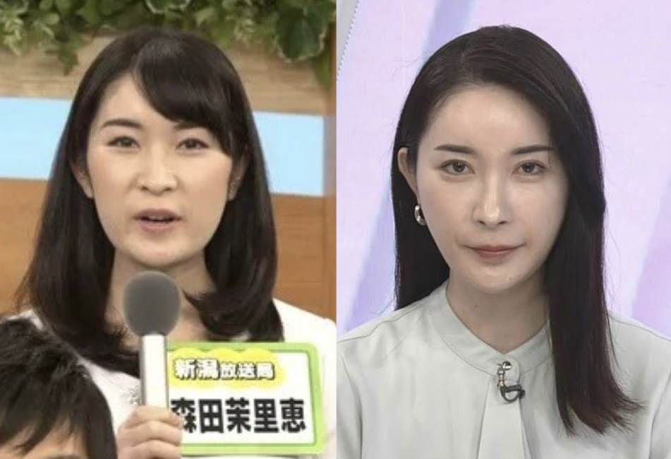 【画像】NHK森田茉里恵アナの鼻が整形級に変化!整形を公表している?